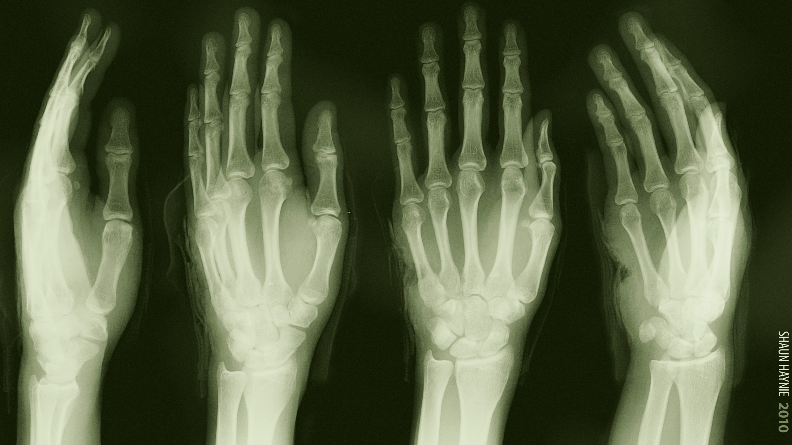 Hand Medical X Ray 2560x1440