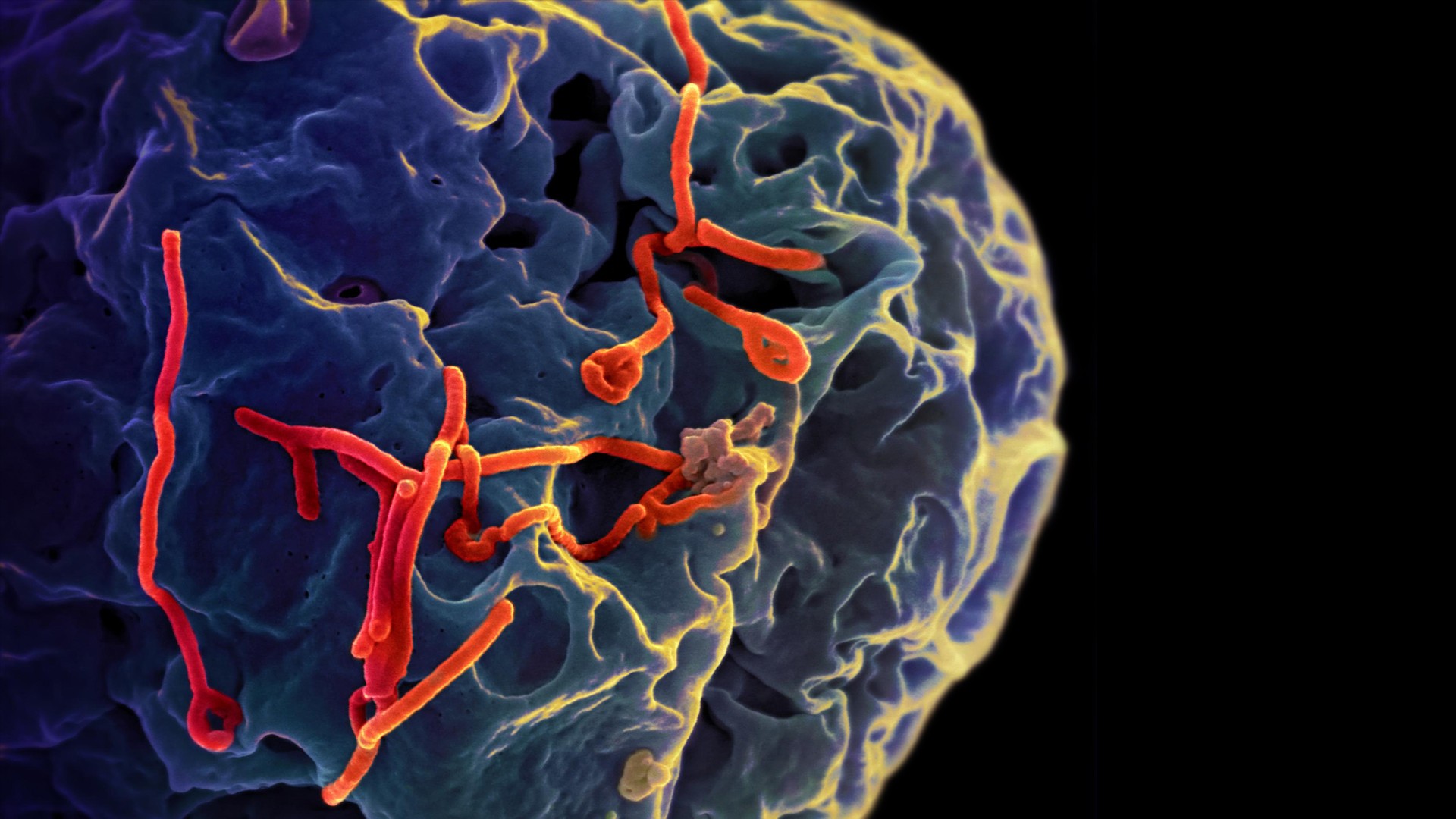 Digital Art Colorful Disease Cells Ebola 1920x1080